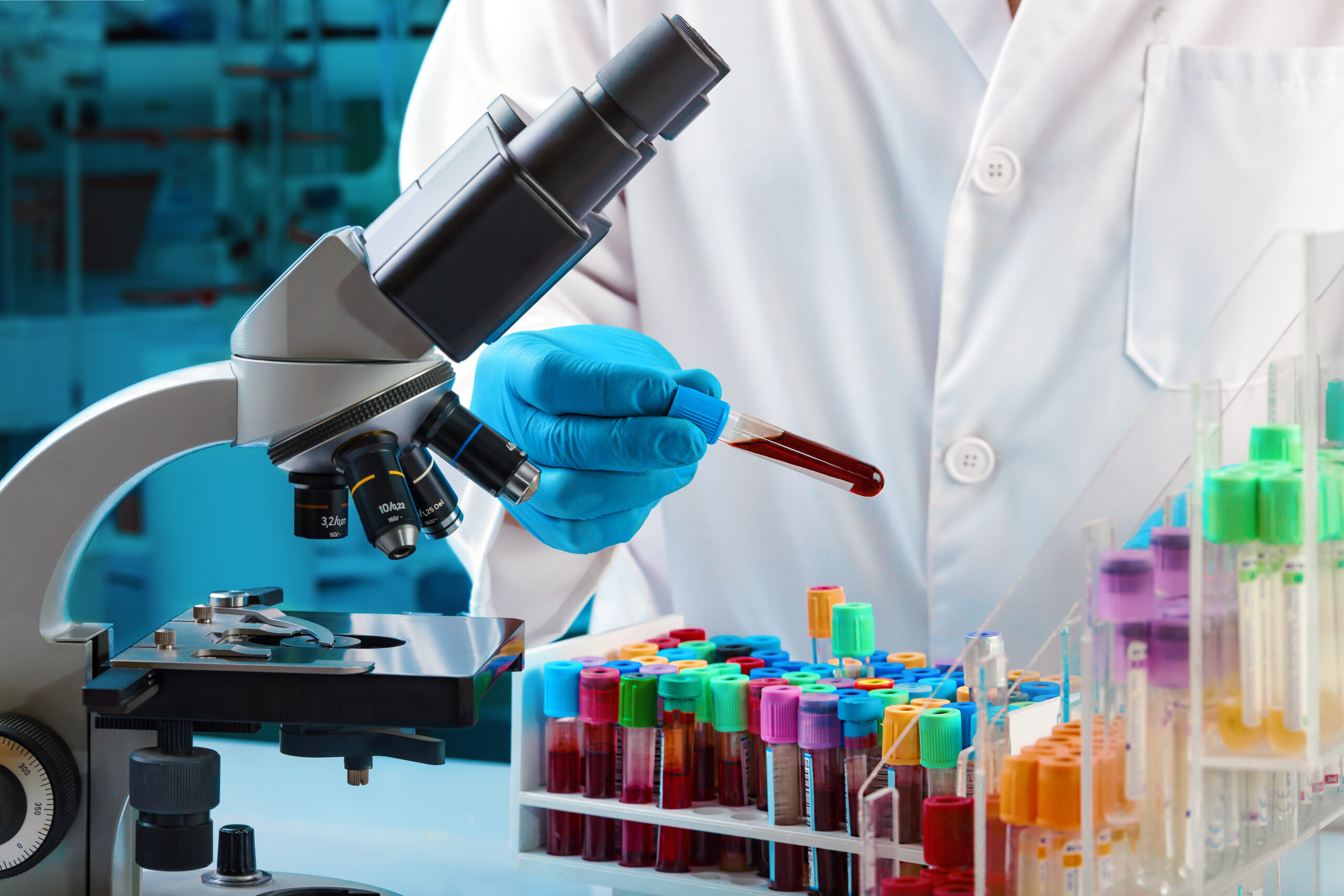 RGCC testing in Webster TX showing circulating tumor cell blood analysis for cancer support