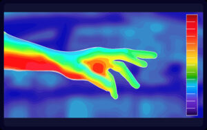 Services 26 Thermography scan being performed in Houston TX as non-invasive alternative to mammogram screening